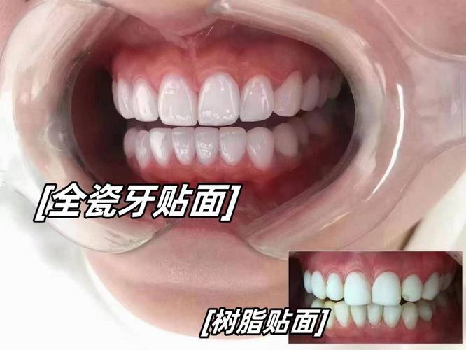 牙齿是什么材质